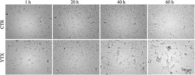 Mitotic Catastrophe in BC3H1 Cells following Yessotoxin Exposure